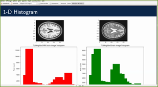 Multimodal image registration